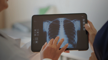 ecg and xray at home